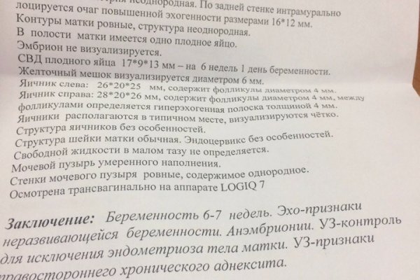 Оригинальные ссылки кракена